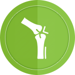 osteoarthritis